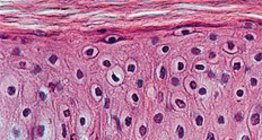 Keratinised stratified squamous