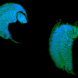 Η προνύμφη σφήκας Iichneumon αναπτύσσεται ως παράσιτο σε drosophila pupa