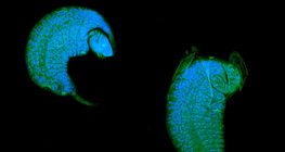 Η προνύμφη σφήκας Iichneumon αναπτύσσεται ως παράσιτο σε drosophila pupa