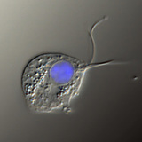 The causative agent of Trichomonas vaginalis (differential interference contrast image, the nucleus is stained blue)