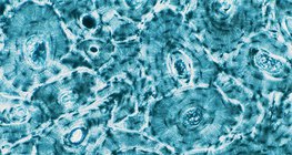 Οστίτης ιστός