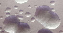 E. coli bacteria colonies (unstained, white)