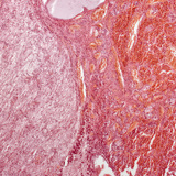 Υπόφυση (διαμήκης τομή, μικρή μεγέθυνση)