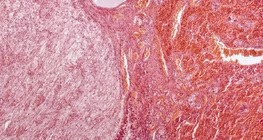 Υπόφυση (διαμήκης τομή, μικρή μεγέθυνση)