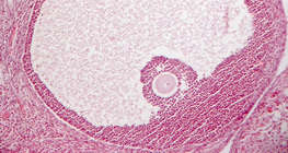 Εγκάρσια τομή ωοθήκης (θηλαστικό)