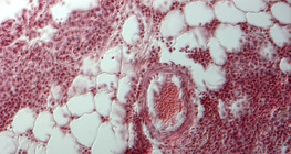 Section of human lung
