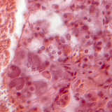 Τμήμα υπόφυσης