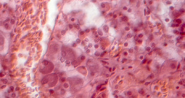 Τμήμα υπόφυσης