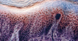 Διατομή δέρματος ανθρώπινου δακτύλου με υποδοχείς