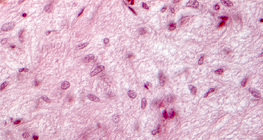 Τμήμα υπόφυσης