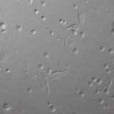 Red blood cells of a Drosophila larva