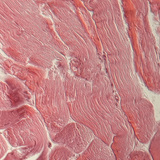 Τένοντας (διατομή)