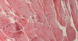 Τένοντας (διατομή)