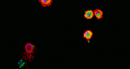 Drosophila haemocytes (stained red) devouring bacteria (stained green)