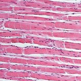 Μυϊκός ιστός