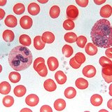 Αιμοποιητικός ιστός