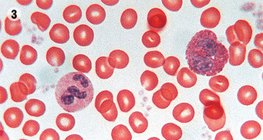 Αιμοποιητικός ιστός