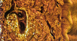 Διατομή δέρματος ανθρώπινου δακτύλου