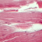 Τένοντας (διαμήκης τομή)