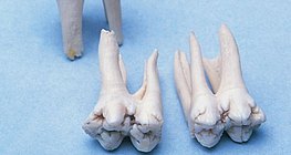 Molars
