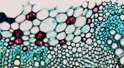 Ποια είναι τα χαρακτηριστικά των ιστών των τραχειόφυτων;