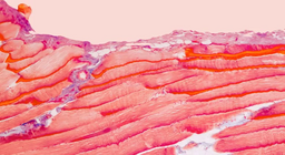 Από ποιους ιστούς αποτελούνται οι μύες μας;