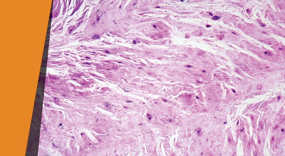 Κατευθυνόμενο χτύπημα