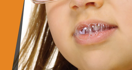 «Διαβρωτικό» σάλιο