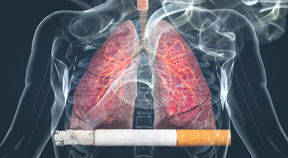 Efeitos do cigarro nos pulmões